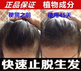 艾芙洛育发液头发增长液快速增长防脱发生发液增发密发生姜洗发水