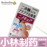 现货日本代购小林制药胳膊手臂大腿去鸡皮肤去角质软化毛囊膏30g