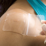 美国百德丝Biodermis疤痕修复贴 小片硅胶贴(5×6 cm) 两片装