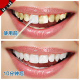 牙齿美白速效去黄牙烟牙黑渍牙菌斑洗牙液牙粉液牙贴膏神器白牙素