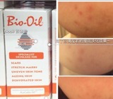bio oil 百洛油万能油60ml 淡化痘疤 肥胖纹妊娠纹疤痕 澳洲代购