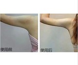 强效特配！瘦手臂精油 强效纤臂针对肌肉水肿脂肪减蝴蝶臂瘦胳膊