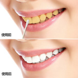 牙齿美白速效去黄牙 牙齿美白牙贴神器 去牙渍烟渍 洗牙水洗牙液
