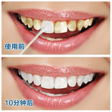 美白牙齿洗牙液洁牙粉强效去烟牙黄牙黑牙齿贝白白牙素牙斑净速效