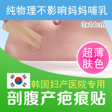 韩国进口可丽尼超薄疤痕贴凹凸剖腹产手术修复淡化增生硅胶祛修疤