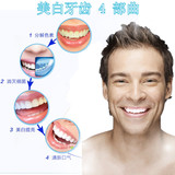 【 买2送1】3D牙贴牙齿美白正品口腔速效神器去黄牙牙污渍氟斑牙