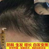 无硅油黑发头发增长液纯天然自制生姜首乌皂角洗发水控油防脱生发