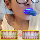 蓝光美牙仪快速洁牙冷光牙齿美白仪神器去除黄牙快速亮白洁牙速效