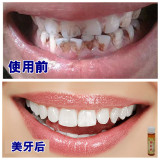洗牙液齿贝白白牙素速效去牙渍烟渍黄牙齿美白粉牙贴洁牙粉洗牙水